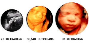 Read more about the article 5D Ultrahang – Mindent, amit tudni kell