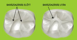 Read more about the article Barázdazárás: Hogy működik és miért fontos a gépjárművek számára