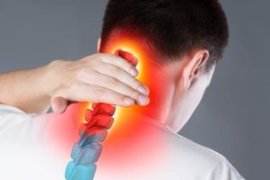 Read more about the article Minden, amit tudni kell a cervicalgiáról