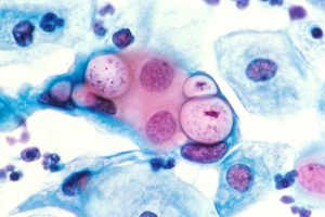 Read more about the article Minden, amit tudni kell a chlamydia-ról