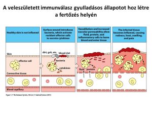 Read more about the article Akut Mit Jelent – Mindent Ami Az Akut Állapotokról Tudni Kell