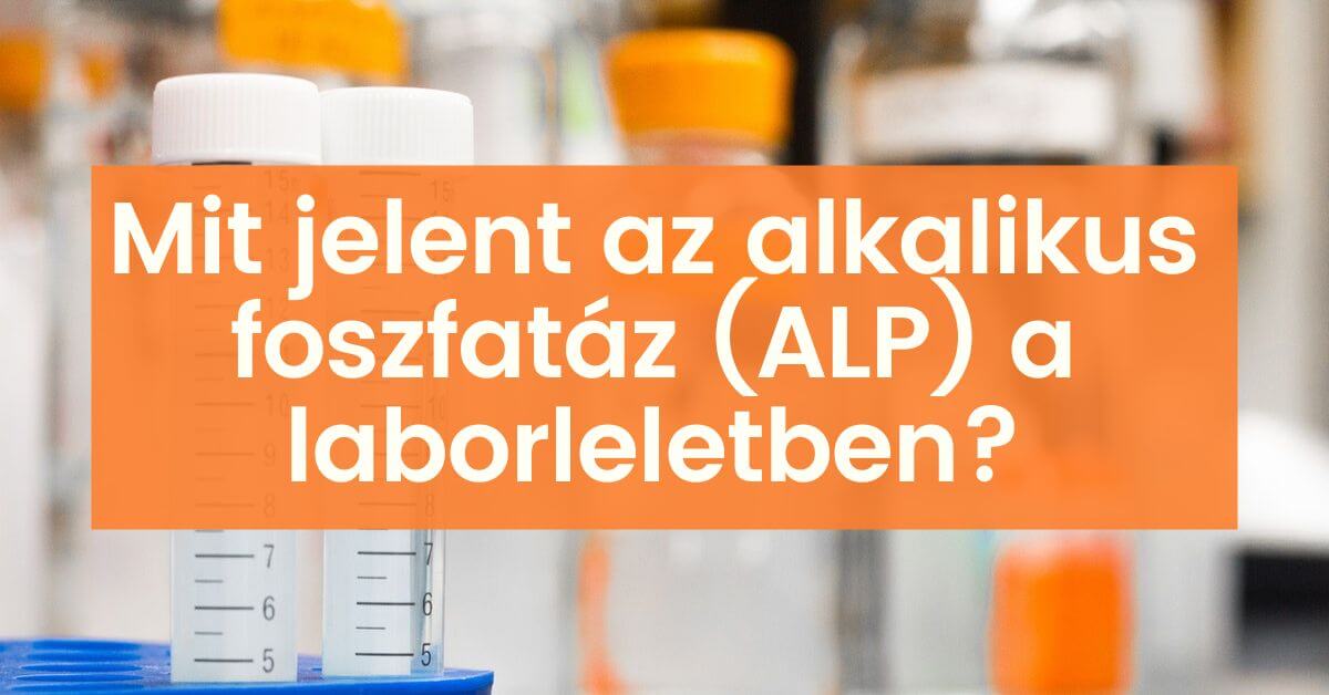 You are currently viewing Minden, amit tudni akartál az ALK foszfatázról