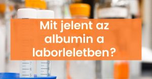 Read more about the article Minden, amit Tudni Akartál az Albuminról