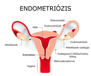 Read more about the article Minden, amit tudni kell az endometriumról