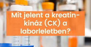 Read more about the article A CK labor jelentése és fontossága az online marketingben