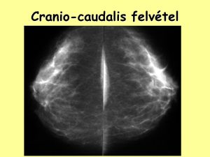 Read more about the article Cranio Caudalis: Mit Jelent és Miért Fontos?