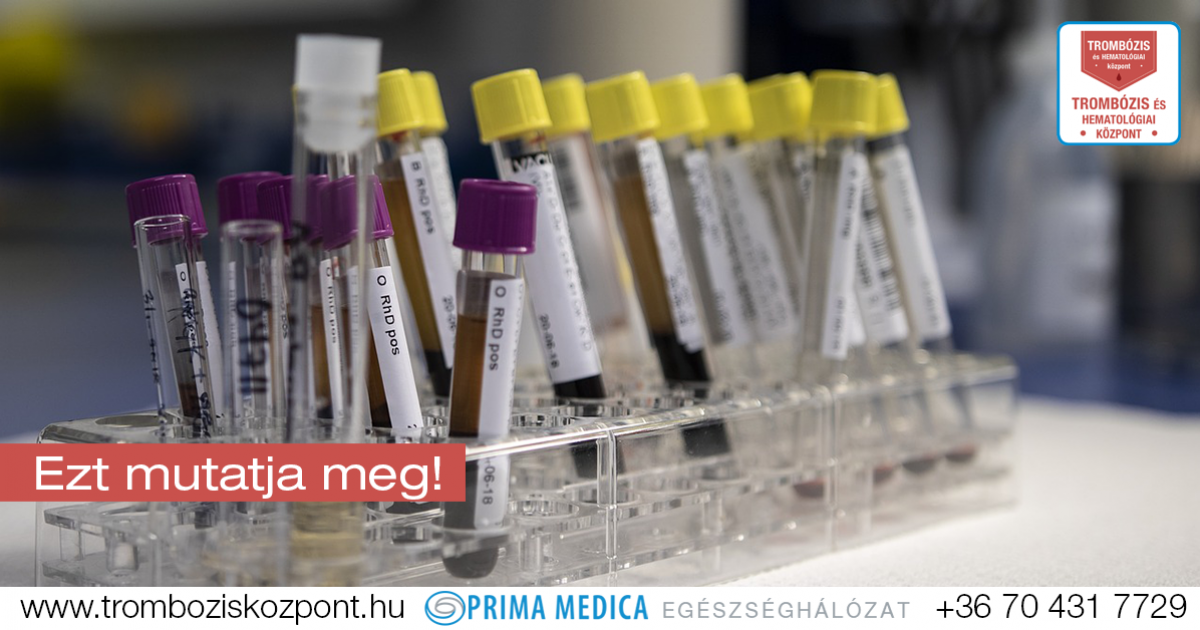 You are currently viewing Minden, amit tudni kell a magas thrombocyta szintről