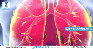 Read more about the article Minden, amit tudni kell a fibrotikus rajzolatról