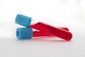 Read more about the article Minden, amit tudni kell a szerológiai vizsgálatokról