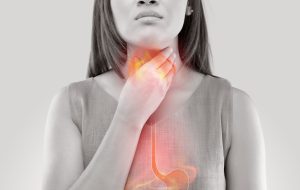 Read more about the article Minden, amit tudni kell az oesophagitis-ről