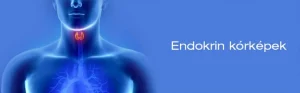 Read more about the article Mindent, amit tudni kell a Struma Diffusa-ról