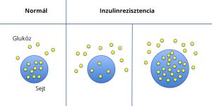 Read more about the article Mit jelent az inzulinrezisztencia?
