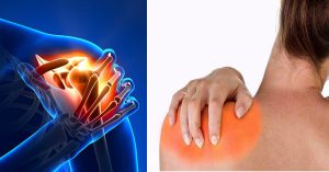 Read more about the article Mit jelent az uncovertebralis arthrosis?