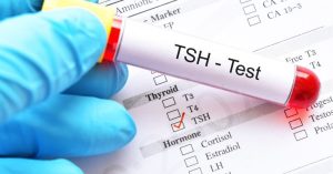 Read more about the article TSH érték magas – Mit jelent ez a tünet?