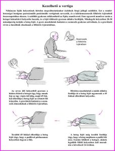 Read more about the article Minden, amit tudni kell a vertebrobasilaris syndromáról