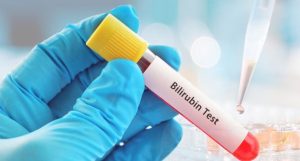 Read more about the article Érthetően magyarázva: Mi is az a bilirubin?