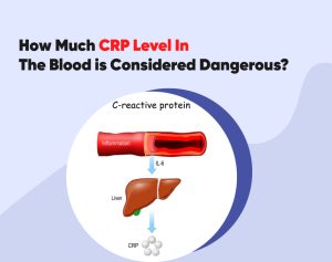 Read more about the article Minden, amit tudni kell a CRP-ről a vérképben