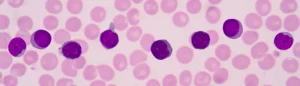 Read more about the article Lymphocyta – Mit Jelent Ez a Fogalom?
