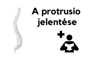 Read more about the article Minden, amit tudni kell a Protrusio-ról: Jelentése és kezelése