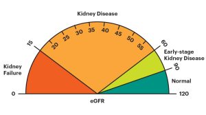 Read more about the article Minden, amit tudni kell az EGFR és az alacsony eGFR értékéről