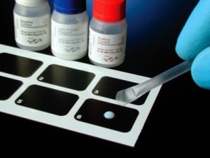 Read more about the article Mindent a AST értékről: Mit jelent és miért fontos?
