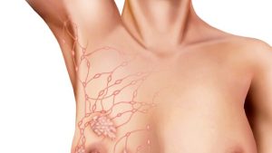 Read more about the article Axilla – Mit Jelent?