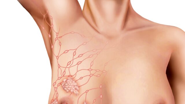 Read more about the article Axilla – Mit Jelent?