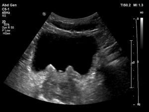 Read more about the article Glandularis emlők – Mi is ez pontosan?