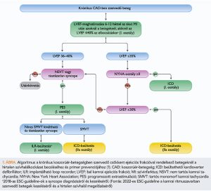 Read more about the article Hypokinetikus diszfunkció: Mi is pontosan ez és milyen tünetekkel jár?
