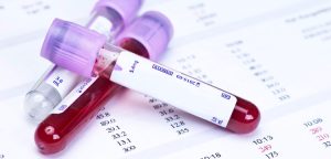 Read more about the article Minden, amit tudni kell a magas hemoglobin szintről
