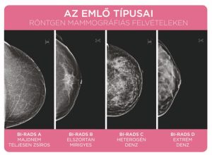 Read more about the article Mirigyes Mell – Mi is Ez Valójában?