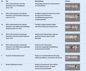 Read more about the article Mindent a „Inkomplett Játékszabályzat” jelentéséről