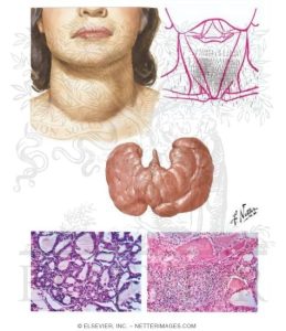 Read more about the article A thyreotoxicosis diffúz golyvával jelentése és kezelése