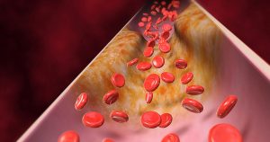 Read more about the article Thrombocyta: Mit Jelent Ez a Kifejezés?